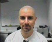 shaved head